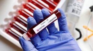 test-kits-2